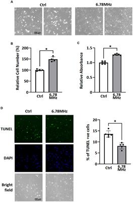 External RF-EMF alters cell number and ROS balance possibly via the regulation of NADPH metabolism and apoptosis